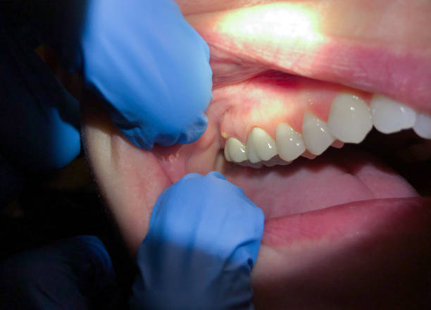 Best Orthodontic Emergency Dentist in Mountain View, AR
